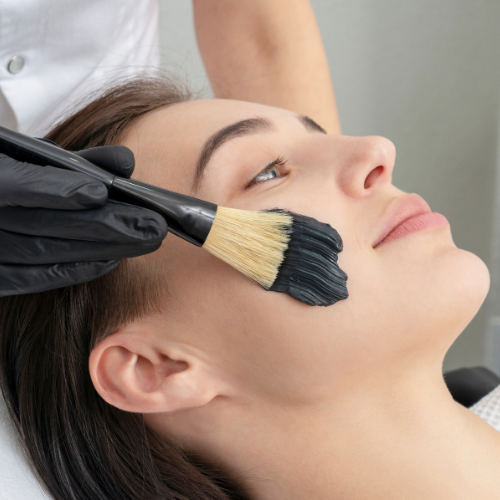 Laser Carbon Peel | Hollywood Peel