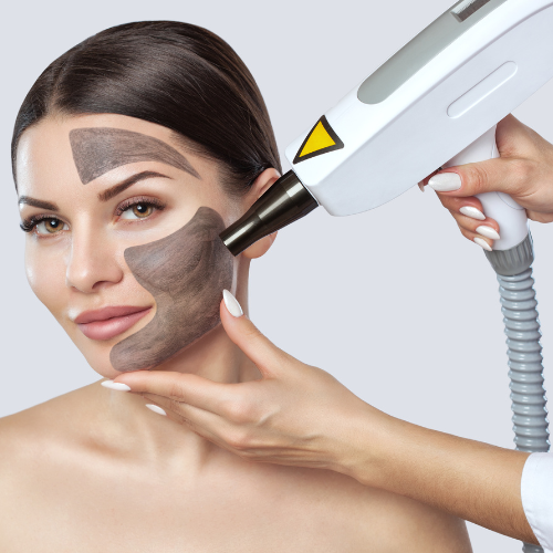 Laser Carbon Peel | Hollywood Peel