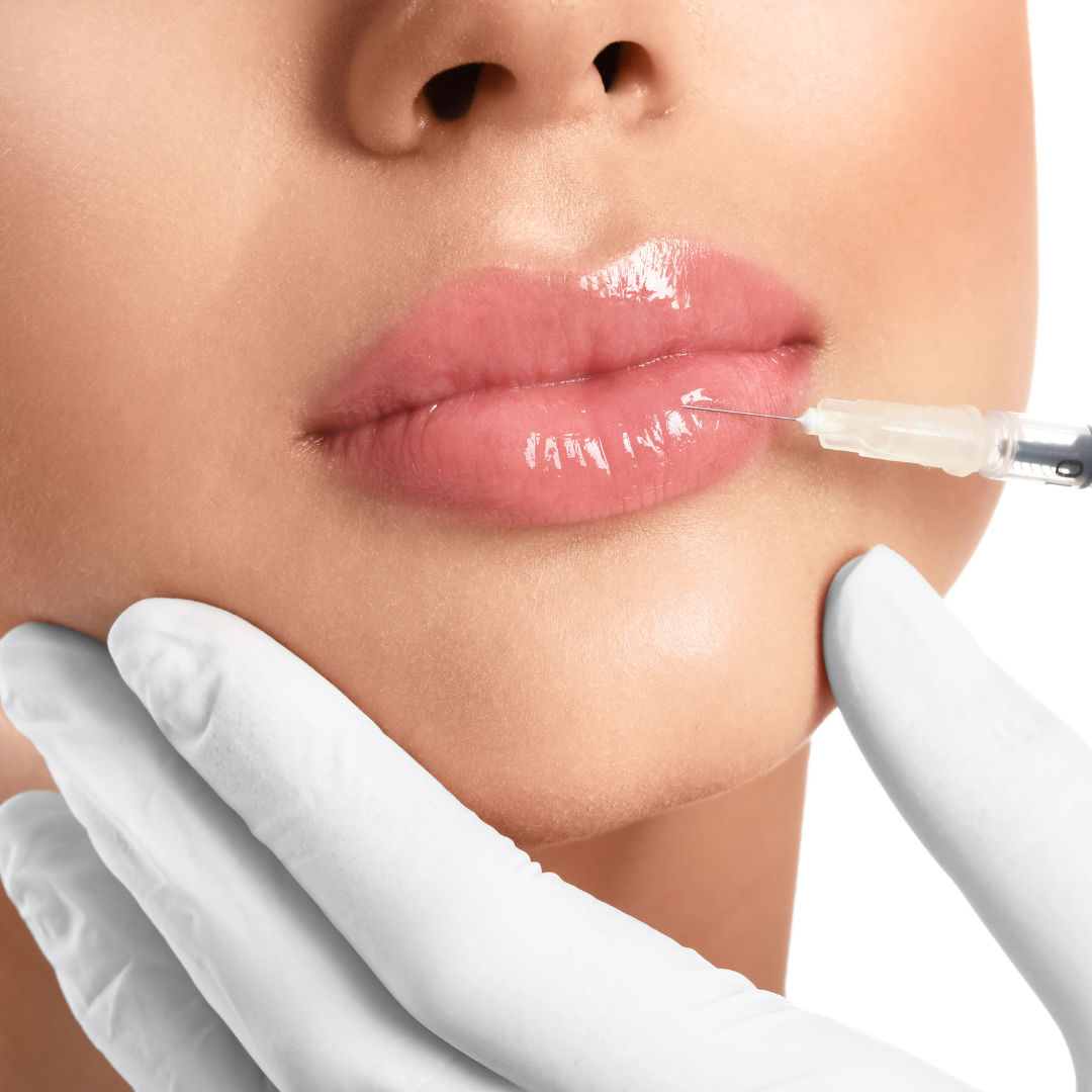 Lip Augmentation