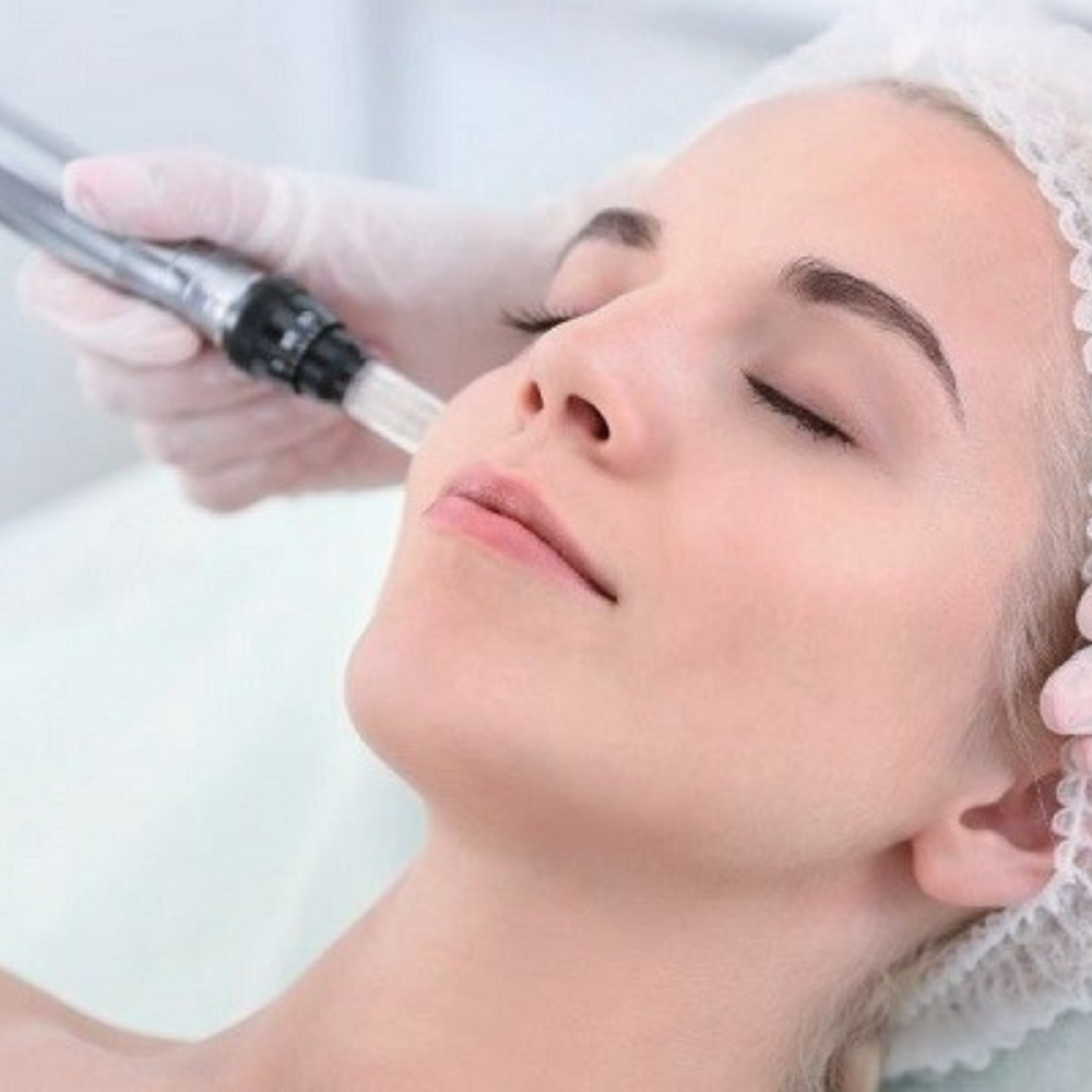 Microneedling 