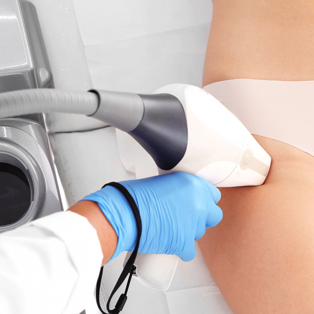 LASER HAIR REMOVAL Encanta Cejas