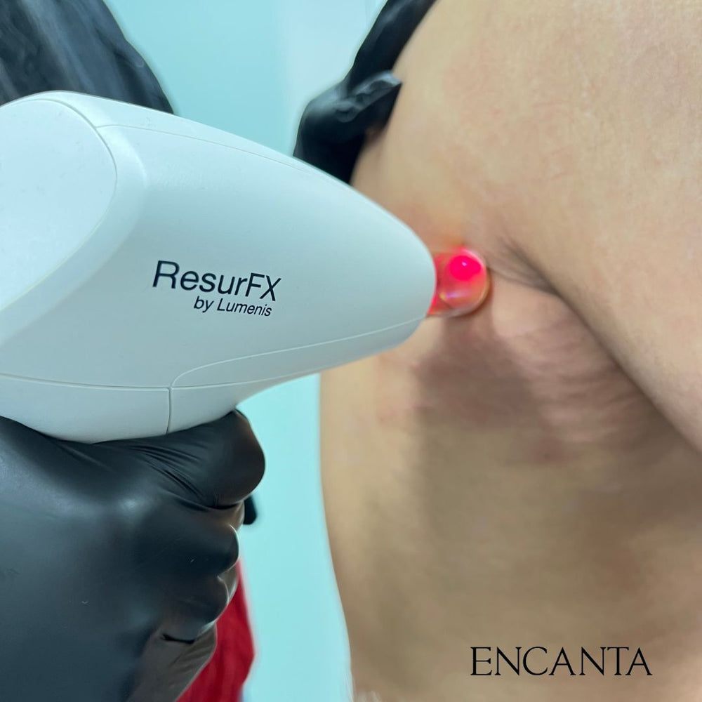 ResurFX Stretch Marks