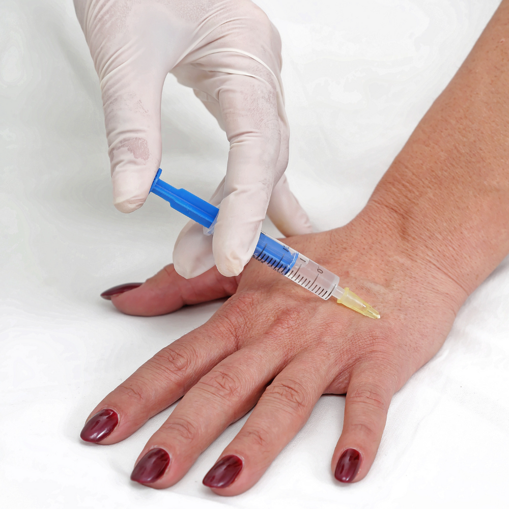 Hand Rejuvenation (2 syringes) | Hand Resurfacing | Encanta Cejas